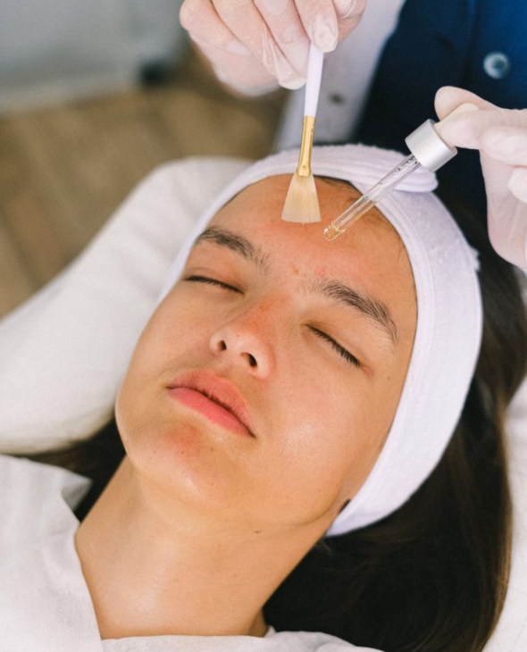 Chemical Peel