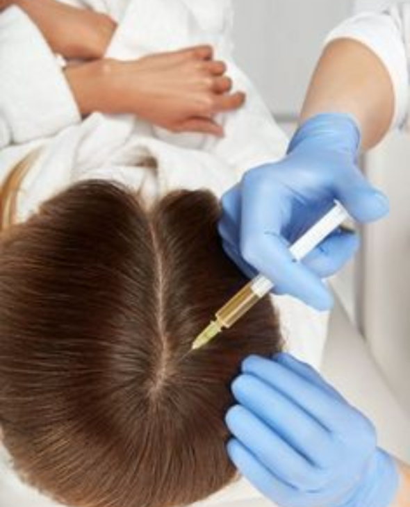 Exosome Hair Therapy