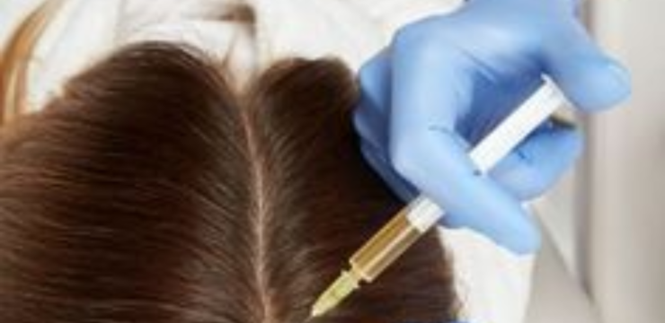 Exosome Hair Therapy