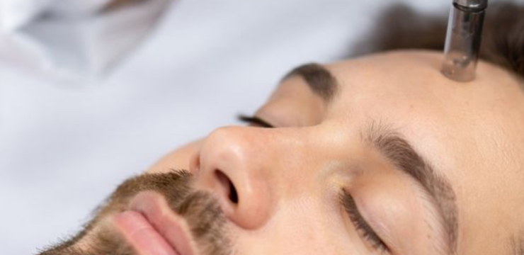 Face Micro Needling