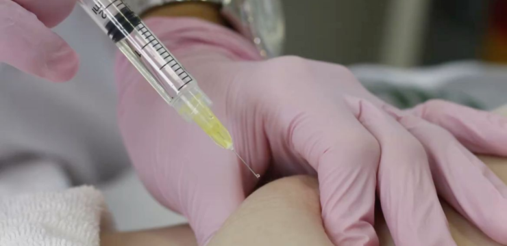 Fat Injection