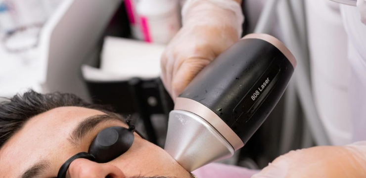 Laser Hair Removal